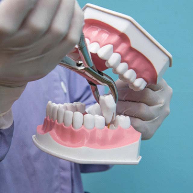 Dental professional using large model to demonstrate tooth extraction