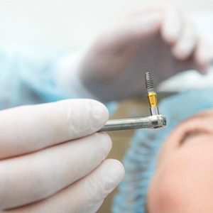 Oral surgeon preparing to place dental implant in patient’s mouth