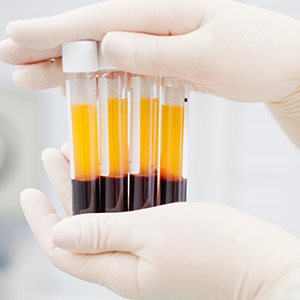 Blood samples after being placed in centrifuge