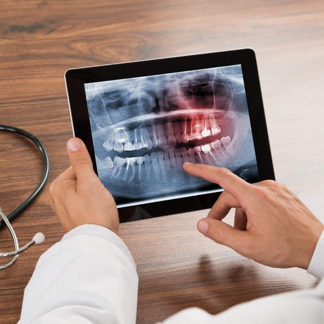 C T scans of smile used to guide oral surgery