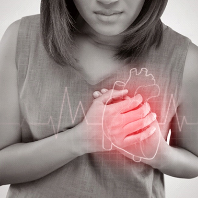 Woman with poor heart health, possibly due to sleep apnea