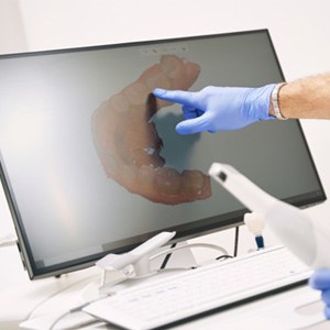 Gloved hand pointing at dental scan on computer
