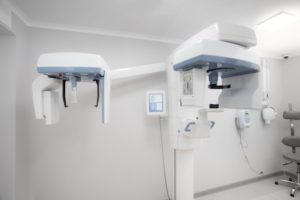 Cone beam scanner in oral surgeon’s office